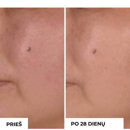 Antioksidacinė šveičiamoji kaukė ANTIOXIDANT EXFOLIATING MASK