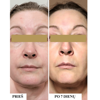 Apsauginis drėkinamasis kremas nuo saulės sausai, jautriai odai SPF 50